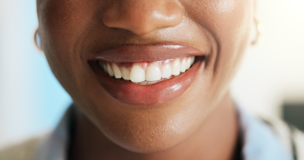 Are Dental Crowns Considered Cosmetic Dentistry?