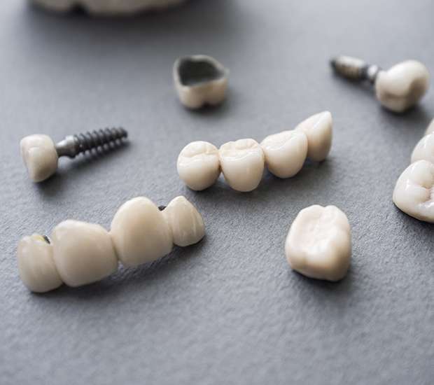 Lancaster The Difference Between Dental Implants and Mini Dental Implants