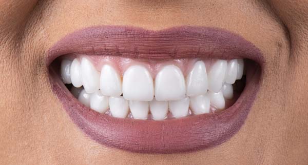 Cosmetic Dentist Procedure Options For Your Smile Makeover